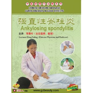 Spondylite  ankylosante